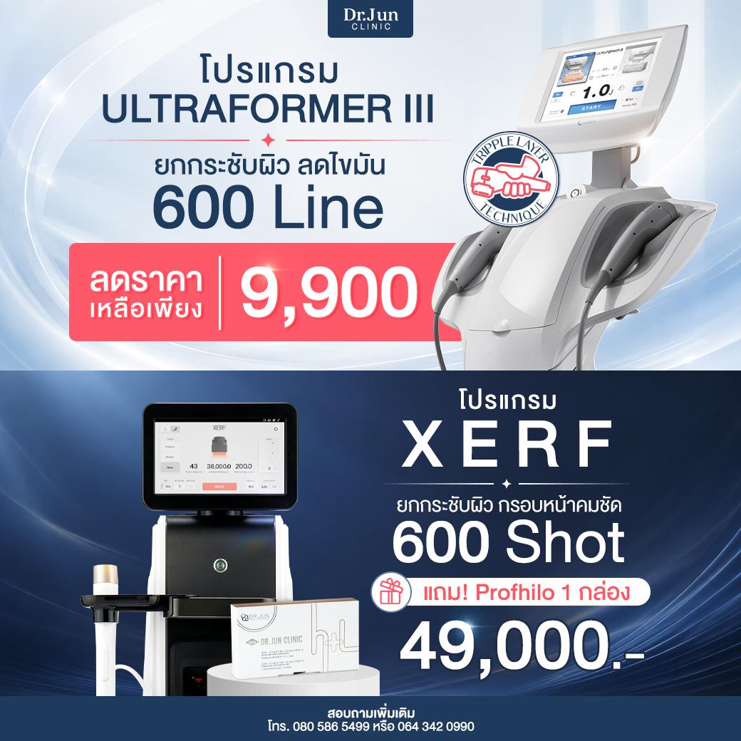 ภาพโปรโมชั่น 3