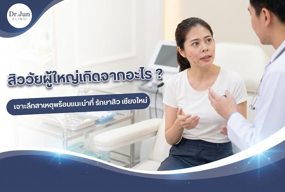 สิววัยผู้ใหญ่เกิดจากอะไร? เจาะลึกสาเหตุพร้อมแนะนำที่ รักษาสิว เชียงใหม่