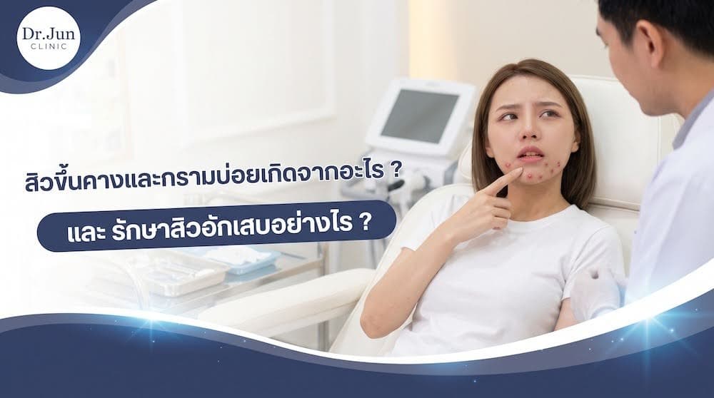 สิวขึ้นคางและกรามบ่อยเกิดจากอะไร และ รักษาสิวอักเสบอย่างไร ?