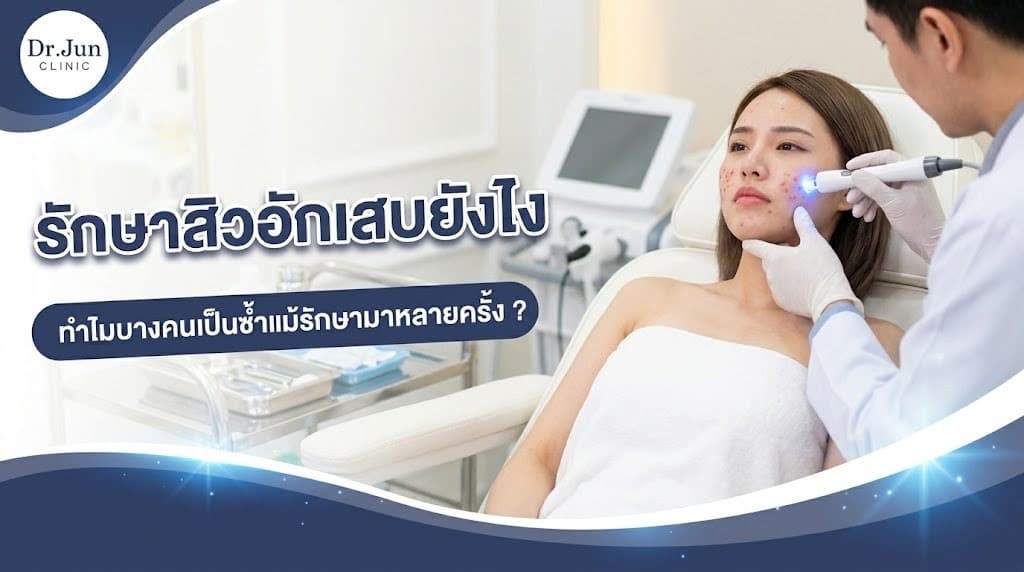 รักษาสิวอักเสบยังไง ทำไมบางคนเป็นซ้ำแม้รักษามาหลายครั้ง ?